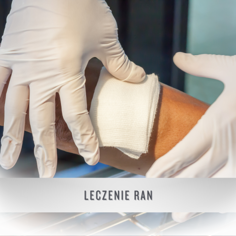 leczenie ran